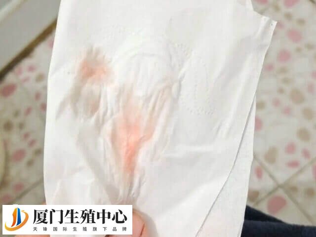 试管移植后有血丝正不正常