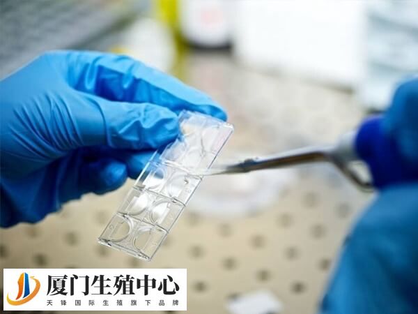 内分泌异常是导致移植后孕酮低的原因之一