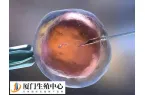 试管婴儿降调加替代方案优势是什么